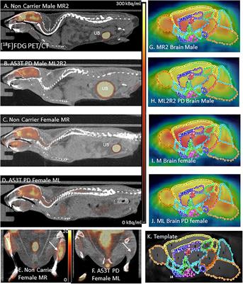 [18F]FDG PET/CT Studies in Transgenic Hualpha-Syn (A53T) Parkinson’s Disease Mouse Model of α-Synucleinopathy